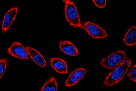 V Olomouci vyvinuli metodu, která spouští chemické reakce podle pH buněk
