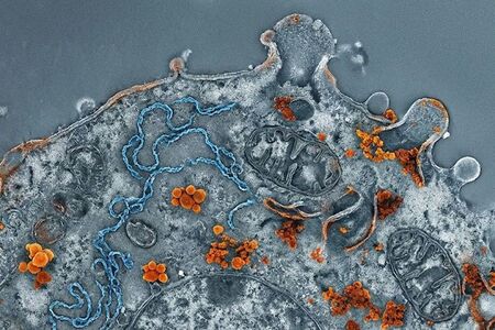 Přinutíme rakovinné buňky k sebedestrukci?