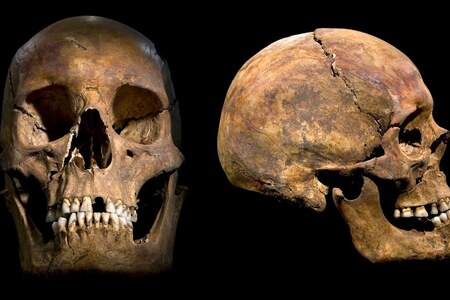 Tělo zemře, zuby zůstávají: Co nám mohou prozradit!