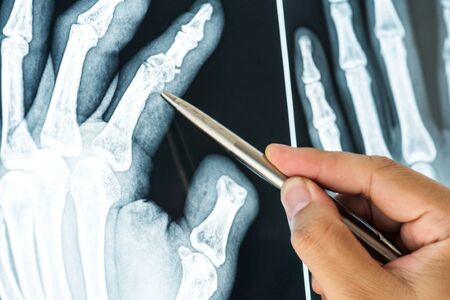 Rentgenové záření: Viděla v něm manželka experimentátora svoji smrt?